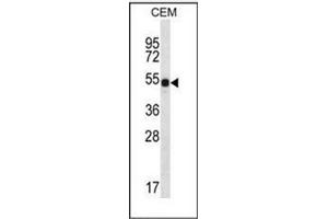 Image no. 2 for anti-Deleted In Azoospermia 3 (DAZ3) (AA 396-426), (C-Term) antibody (ABIN951839)