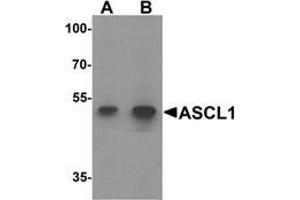 Image no. 1 for anti-Acyl-CoA Synthetase Long-Chain Family Member 1 (Acsl1) (Middle Region) antibody (ABIN1450035)