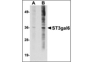 Image no. 2 for anti-ST3 beta-Galactoside alpha-2,3-Sialyltransferase 6 (ST3GAL6) (C-Term) antibody (ABIN500813)