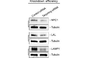 Image no. 3 for anti-Lipase A, Lysosomal Acid, Cholesterol Esterase (LIPA) (Center) antibody (ABIN2854960)