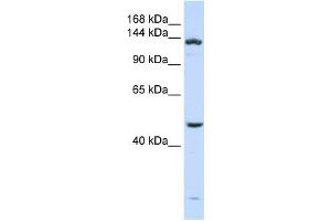 Image no. 1 for anti-ADAM Metallopeptidase with thrombospondin Type 1 Motif, 18 (ADAMTS18) (N-Term) antibody (ABIN633175)