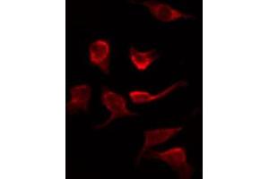 Image no. 2 for anti-V-Raf-1 Murine Leukemia Viral Oncogene Homolog 1 (RAF1) (pSer621) antibody (ABIN6256385)
