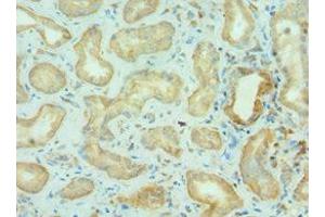 Immunohistochemistry of paraffin-embedded human kidney tissue using ABIN7145825 at dilution of 1:100
