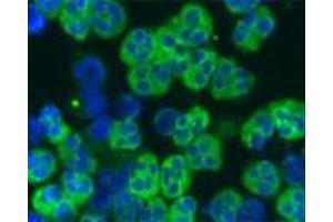 Image no. 3 for anti-Cathelicidin Antimicrobial Peptide (CAMP) antibody (ABIN350187)