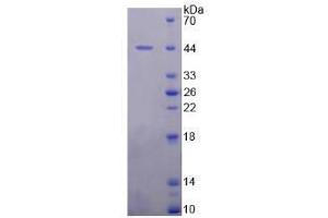 Image no. 1 for Mdm2, p53 E3 Ubiquitin Protein Ligase Homolog (Mouse) (MDM2) (AA 1-321) (Active) protein (His tag) (ABIN6239916)