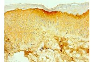 Immunohistochemistry of paraffin-embedded human skin tissue using ABIN7171754 at dilution of 1:100