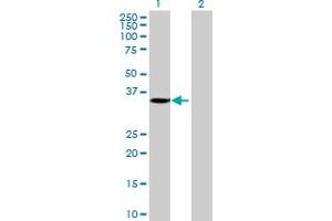 anti-Solute Carrier Family 25, Member 42 (SLC25A42) (AA 1-318) antibody