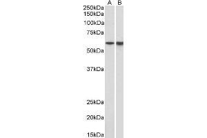 Image no. 1 for anti-Lymphocyte-Specific Protein tyrosine Kinase (LCK) (AA 39-52) antibody (ABIN987272)