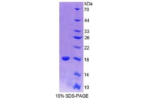 Image no. 1 for Paired Box 6 (PAX6) (AA 1-130) protein (His tag) (ABIN6237553)