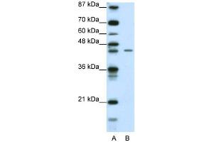 WB Suggested Anti-ZNF17 Antibody Titration: 0.