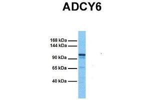 Image no. 2 for anti-Adenylate Cyclase 6 (ADCY6) (C-Term) antibody (ABIN2782842)