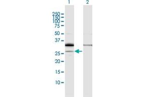 Image no. 1 for anti-Phosphatidic Acid Phosphatase Type 2A (PPAP2A) (AA 1-284) antibody (ABIN948710)