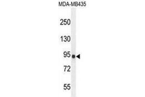 Image no. 3 for anti-Interleukin 12 Receptor, beta 2 (IL12RB2) (AA 759-788), (C-Term) antibody (ABIN952881)