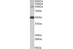Image no. 1 for anti-Patched Domain Containing 1 (PTCHD1) (Internal Region) antibody (ABIN571261)