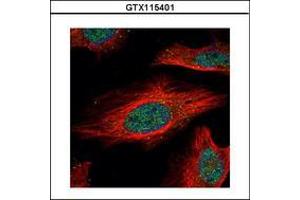 Image no. 3 for anti-Interferon Regulatory Factor 9 (IRF9) (AA 171-393) antibody (ABIN1498905)