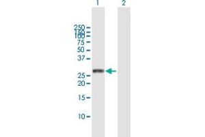 Image no. 1 for anti-Deoxyuridine Triphosphatase (DUT) (AA 1-252) antibody (ABIN515114)