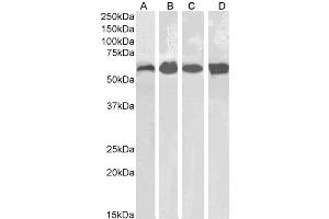 Image no. 2 for anti-Catalase (CAT) (Internal Region) antibody (ABIN185651)