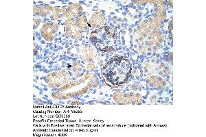 CLIC5 antibody  (C-Term)