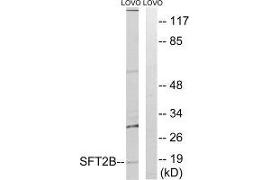Image no. 1 for anti-Vesicle Transport Protein SFT2B (SFT2B) (Internal Region) antibody (ABIN1852378)