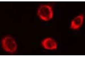Image no. 2 for anti-Peroxisomal Biogenesis Factor 5 (PEX5) (Internal Region) antibody (ABIN6264151)