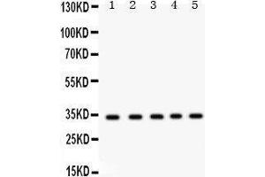 Image no. 2 for anti-Estrogen Receptor Binding Site Associated, Antigen, 9 (EBAG9) (AA 31-213) antibody (ABIN3043569)