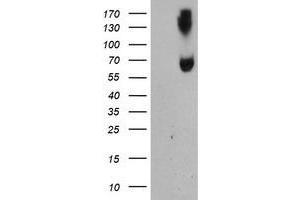 Image no. 1 for anti-Acyl-CoA Synthetase Medium-Chain Family Member 5 (ACSM5) antibody (ABIN2715690)
