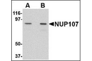 Image no. 2 for anti-Nucleoporin 107kDa (NUP107) (C-Term) antibody (ABIN500395)