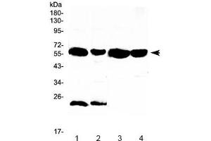 Image no. 4 for anti-UDP Glucuronosyltransferase 1 Family, Polypeptide A1 (UGT1A1) antibody (ABIN5708492)