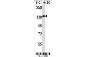 Image no. 1 for anti-Glutamate Receptor, Metabotropic 1 (GRM1) (AA 1096-1126), (C-Term) antibody (ABIN652203)