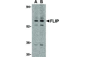 Image no. 1 for anti-CASP8 and FADD-Like Apoptosis Regulator (CFLAR) (N-Term) antibody (ABIN6656653)