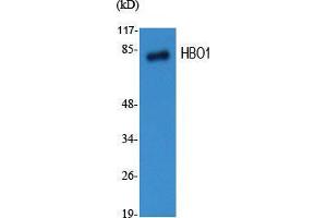 Image no. 2 for anti-MYST Histone Acetyltransferase 2 (MYST2) (Internal Region) antibody (ABIN3184974)