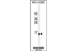 Image no. 1 for anti-Sperm Associated Antigen 11A (SPAG11A) (AA 14-42), (N-Term) antibody (ABIN654791)