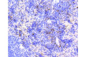 Image no. 1 for anti-Antigen Identified By Monoclonal Antibody Ki-67 (MKI67) antibody (ABIN4904148)