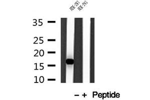Image no. 2 for anti-Intraflagellar Transport 20 Homolog (IFT20) antibody (ABIN6262478)