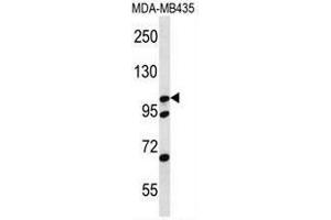 Image no. 3 for anti-Catenin (Cadherin-Associated Protein), delta 2 (Neural Plakophilin-Related Arm-Repeat Protein (CTNND2) (AA 1130-1159), (C-Term) antibody (ABIN951062)