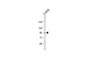 Image no. 3 for anti-Enhancer of Polycomb Homolog 2 (EPC2) (AA 205-233), (N-Term) antibody (ABIN651410)