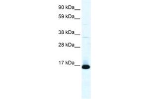 Image no. 1 for anti-Transcription Factor 21 (TCF21) antibody (ABIN2460724)