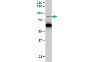 Image no. 7 for anti-K(lysine) Acetyltransferase 2B (KAT2B) (AA 353-452) antibody (ABIN522308)