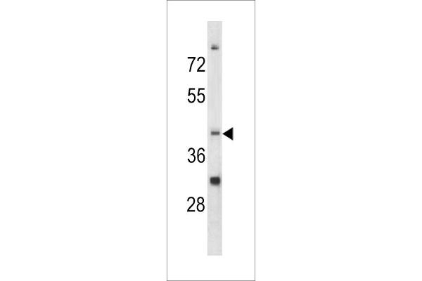 CCRN4L antibody  (C-Term)
