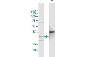 Image no. 1 for anti-Monoacylglycerol O-Acyltransferase 2 (MOGAT2) (AA 1-284) antibody (ABIN949667)