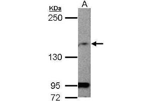 Image no. 1 for anti-Membrane Associated Guanylate Kinase, WW and PDZ Domain Containing 1 (MAGI1) (C-Term) antibody (ABIN2855438)