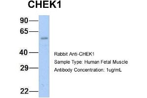Image no. 2 for anti-Checkpoint Kinase 1 (CHEK1) (Middle Region) antibody (ABIN2779737)