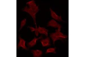 Image no. 1 for anti-Adenosine A3 Receptor (ADORA3) (C-Term) antibody (ABIN6259513)