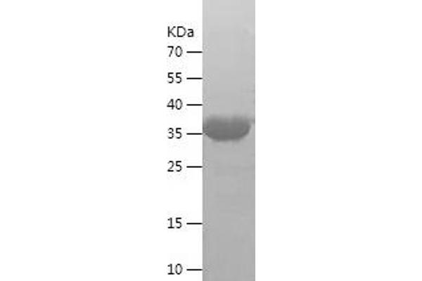 c-FOS Protein (AA 2-180) (IF2DI tag)