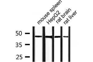 Image no. 3 for anti-COP9 Signalosome Complex Subunit 3 (COPS3) (C-Term) antibody (ABIN6260969)