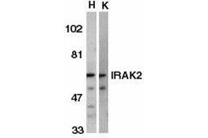 Image no. 1 for anti-Interleukin-1 Receptor-Associated Kinase 2 (IRAK2) (AA 546-564) antibody (ABIN187751)