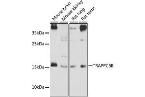 Image no. 1 for anti-Trafficking Protein Particle Complex 6B (TRAPPC6B) antibody (ABIN6568756)