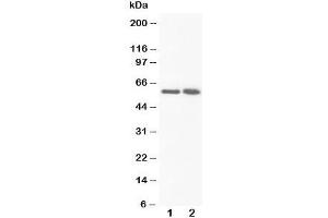 Image no. 2 for anti-Flavin Containing Monooxygenase 3 (FMO3) (N-Term) antibody (ABIN3030969)