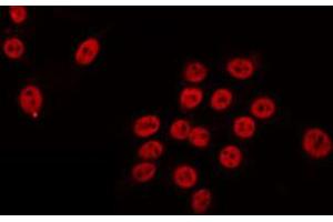 Image no. 1 for anti-RAD54-Like (RAD54L) (C-Term) antibody (ABIN6259230)