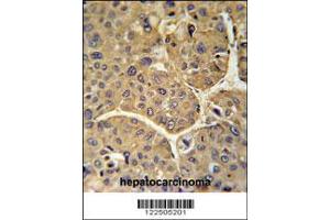 Image no. 3 for anti-Complement Factor H-Related 5 (CFHR5) (AA 203-231) antibody (ABIN651876)